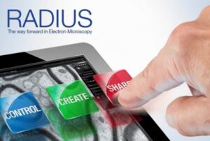 radius1-400×269